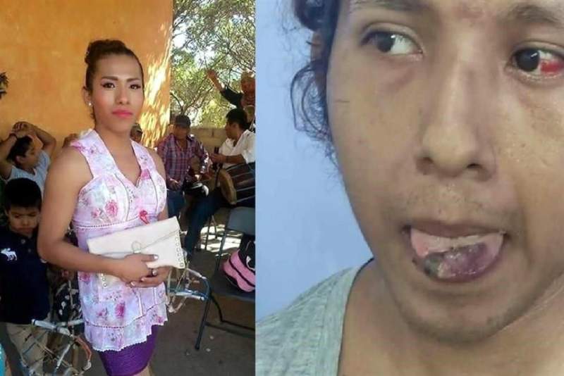 Intentan cortar lengua a mujer trans en Oaxaca